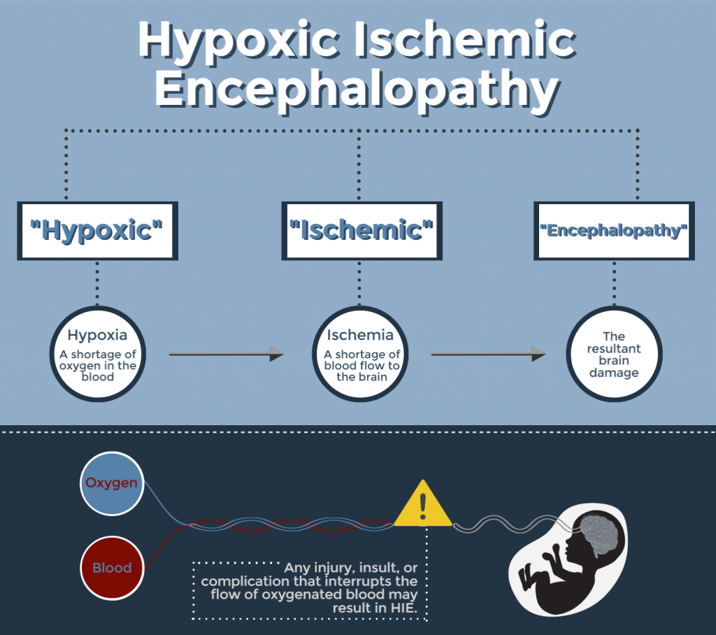 Hypoxic Ischemic Encephalopathy – Medical Law